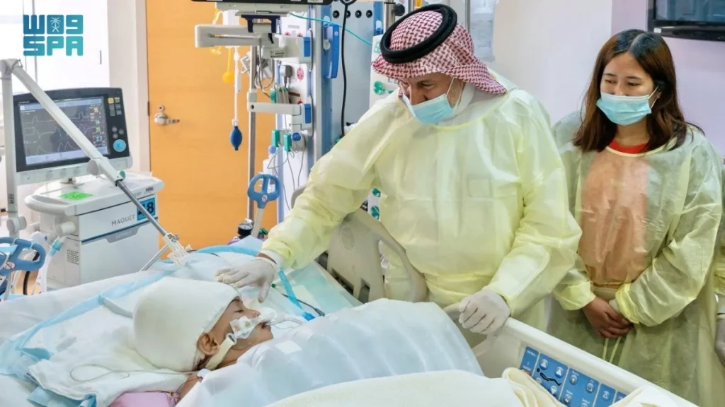 Filipino conjoined twins stable one week after successful separation